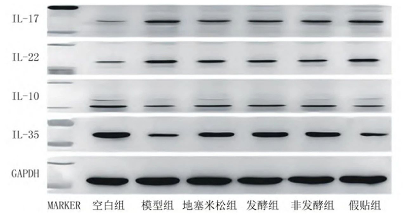 空白組和支氣管哮喘各組大鼠肺組織中IL－17、IL－22、IL－10、IL－35蛋白表達(dá)電泳圖
